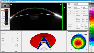 Equipo PENTACAM HR para topografía corneal y diagnóstico de queratocono en Bogotá