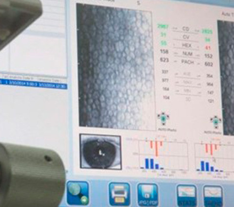 Microscopía especular para evaluación de células endoteliales de la córnea en Bogotá